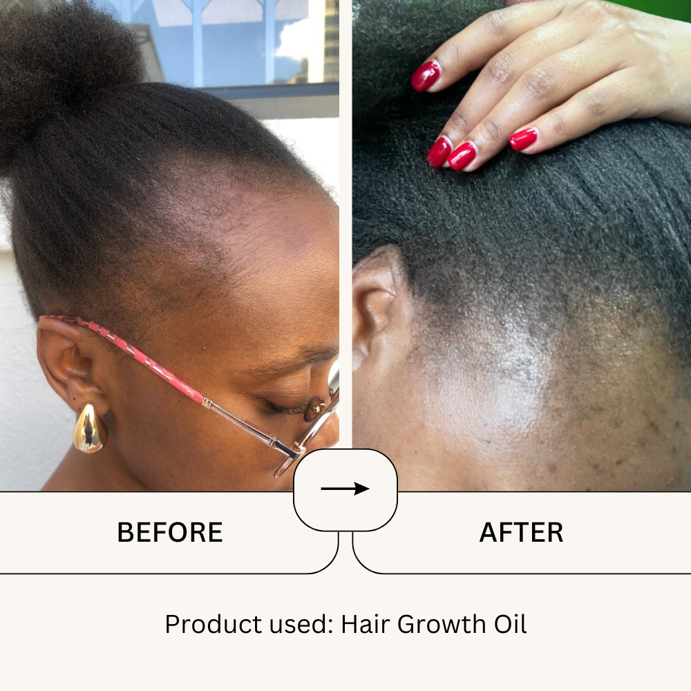 Growth Oil