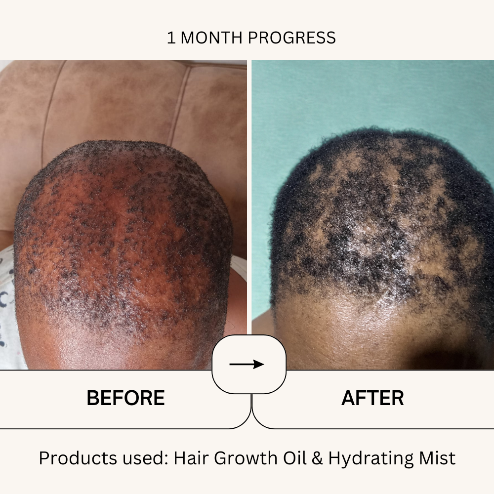 Jojoba Oil-7